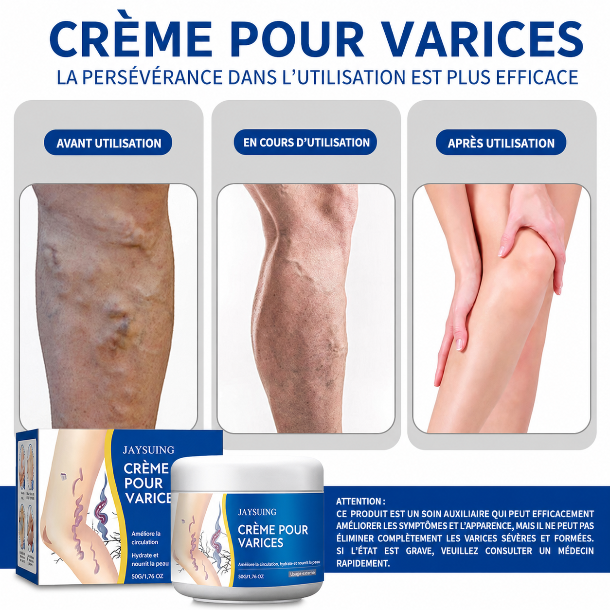 Crème Anti Varices ✨