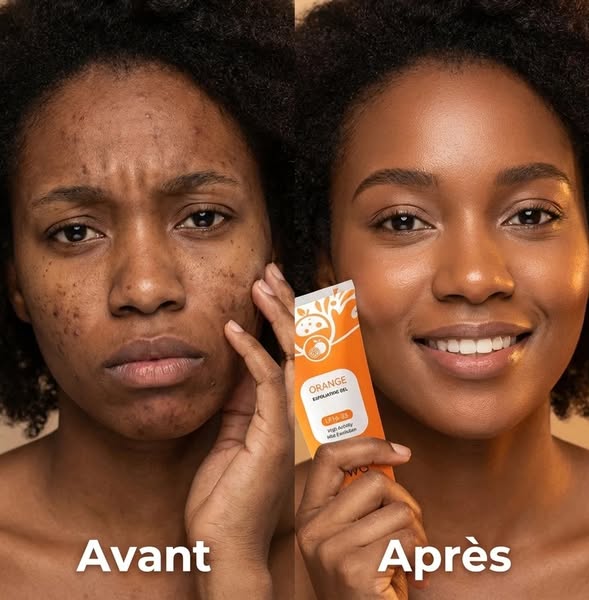 Application du gel exfoliant Orange sur le visage - avant apres