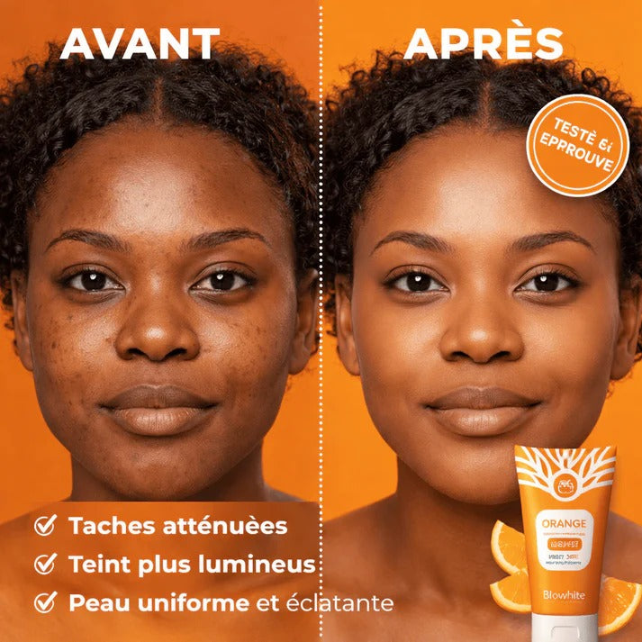 Gel exfoliant Orange Vitamine C - avant apres taches attenuees teint lumineux